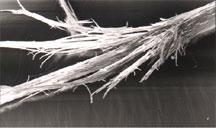 TRAUMATIC HAIR LOSS OR BREAKAGE